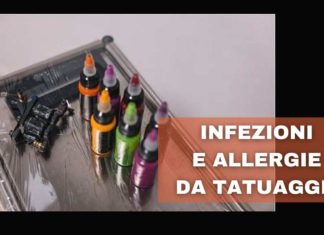 Tatuaggio infezione