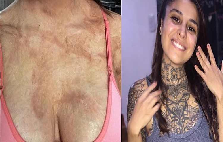 tatuaggio copri cicatrice