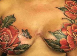 tatuaggio mastectomia