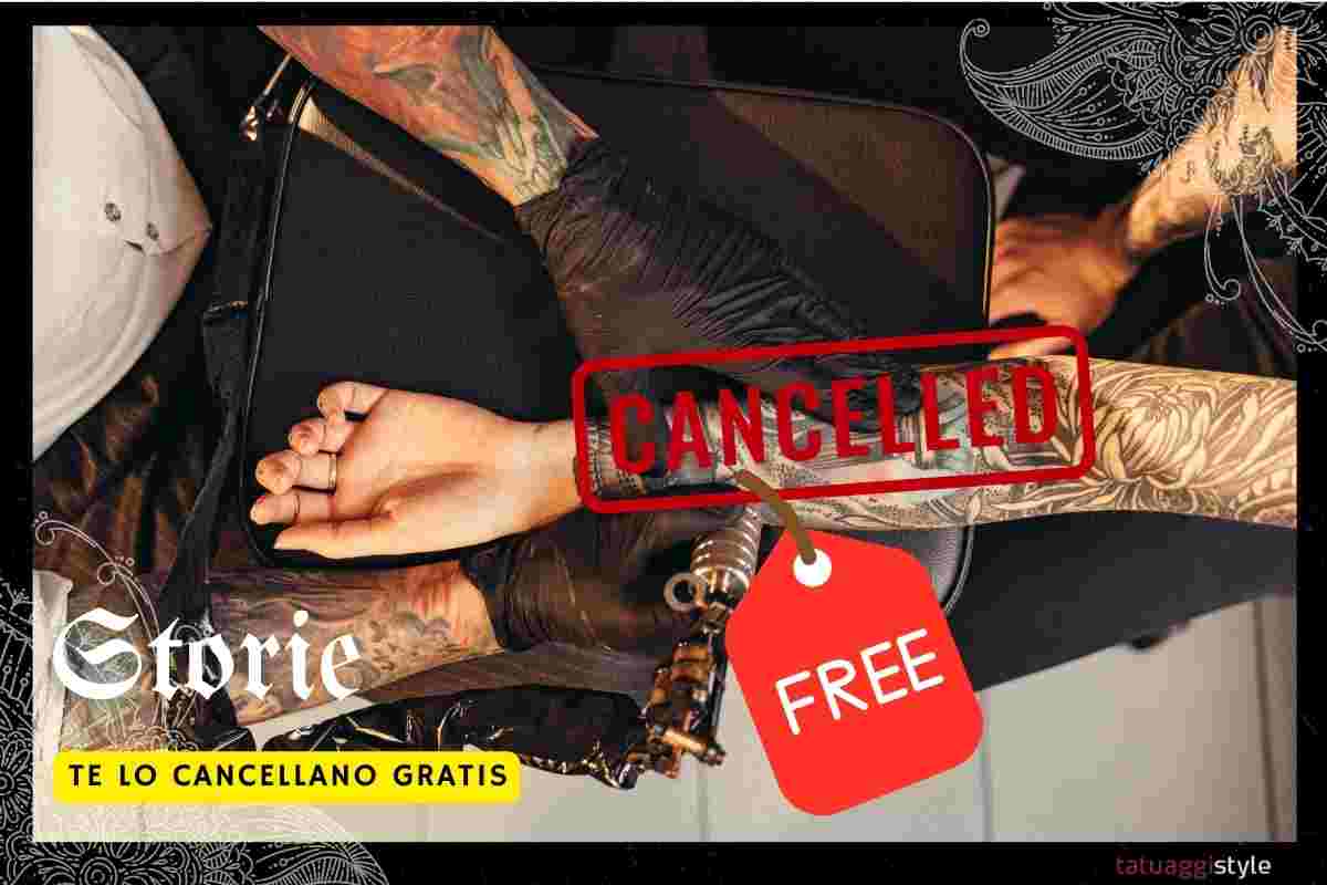 cancellazione gratis tatuaggi