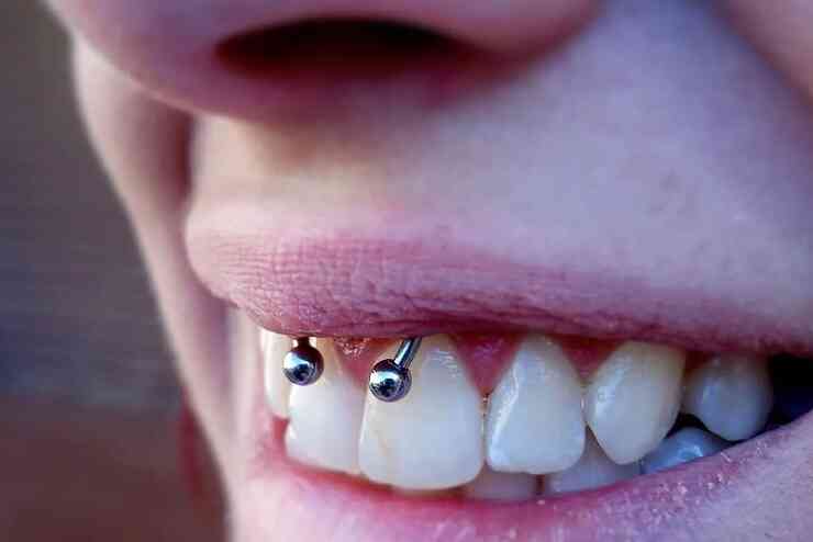 smiley piercing